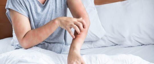 štípance z postele