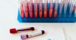 nejlepší léky na ředění krve